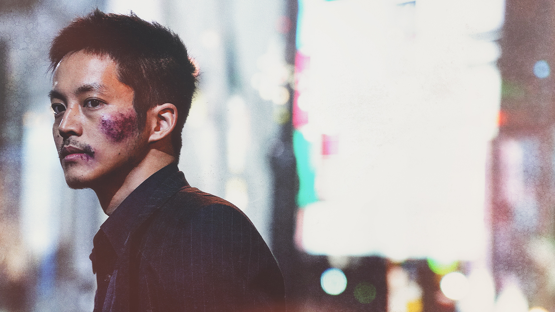 man with bruised face